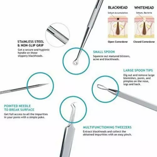 Monwell™ Precision Blackhead Remover Toolkit – Luxury Stainless Steel Pore Extractor Set