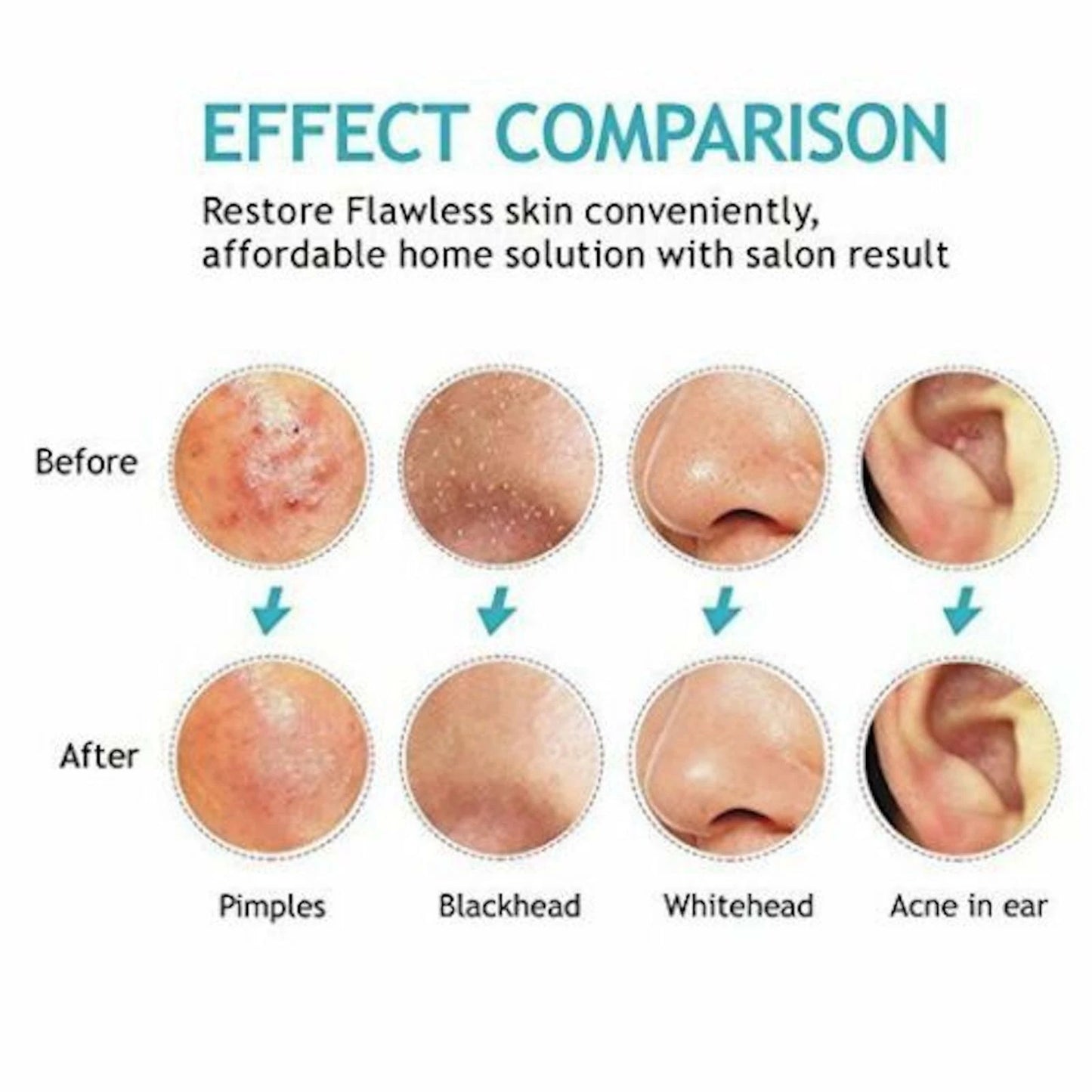 Monwell Clarity Set — Blackhead Remover Toolkit + White Truffle Hydrating Mist